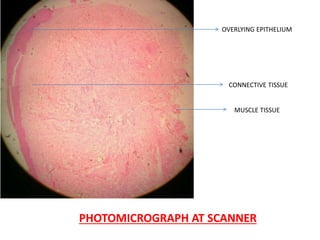 PHOTOMICROGRAPH AT SCANNER
OVERLYING EPITHELIUM
CONNECTIVE TISSUE
MUSCLE TISSUE
 