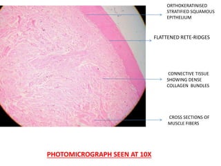PHOTOMICROGRAPH SEEN AT 10X
CROSS SECTIONS OF
MUSCLE FIBERS
ORTHOKERATINISED
STRATIFIED SQUAMOUS
EPITHELIUM
CONNECTIVE TISSUE
SHOWING DENSE
COLLAGEN BUNDLES
FLATTENED RETE-RIDGES
 
