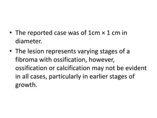 • The reported case was of 1cm × 1 cm in
diameter.
• The lesion represents varying stages of a
fibroma with ossification, however,
ossification or calcification may not be evident
in all cases, particularly in earlier stages of
growth.
 