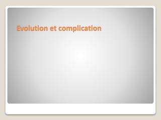 Evolution et complication
 