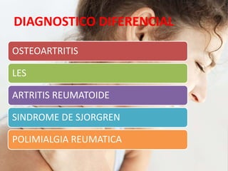 DIAGNOSTICO DIFERENCIAL
OSTEOARTRITIS
LES
ARTRITIS REUMATOIDE
SINDROME DE SJORGREN
POLIMIALGIA REUMATICA
 