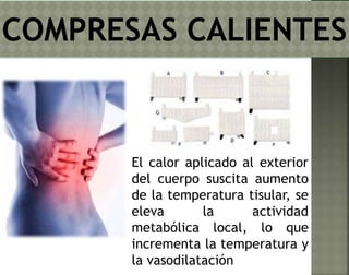 El calor aplicado al exterior 
del cuerpo suscita aumento 
de la temperatura tisular, se 
eleva la actividad 
metabólica local, lo que 
incrementa la temperatura y 
la vasodilatación 
 