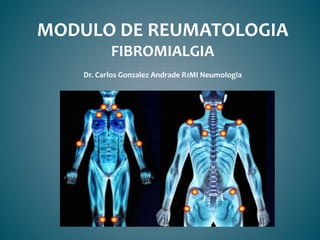 MODULO DE REUMATOLOGIA
FIBROMIALGIA
Dr. Carlos Gonzalez Andrade R1MI Neumologia
 