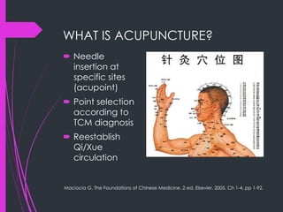 WHAT IS ACUPUNCTURE?
 Needle
insertion at
specific sites
(acupoint)
 Point selection
according to
TCM diagnosis
 Reestablish
Qi/Xue
circulation
Maciocia G. The Foundations of Chinese Medicine. 2 ed. Elsevier. 2005. Ch 1-4, pp 1-92.
 