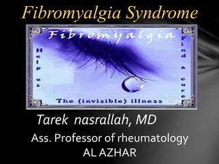 Tarek nasrallah, MD
Ass. Professor of rheumatology
AL AZHAR
Fibromyalgia Syndrome
 