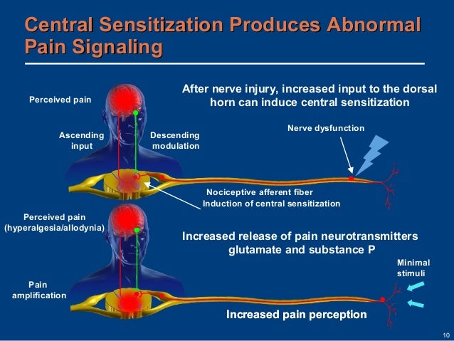 Fibromyalgia disease overview Fibromyalgia disease overview