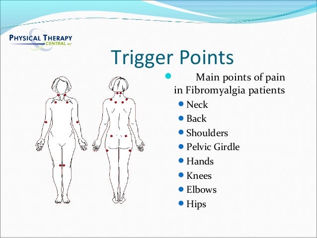trigger points fibromyalgia diagram fibromyalgia points tenderness diagram 28 images trigger points fibromyalgia diagram fibromyalgia points tenderness diagram 28 images
