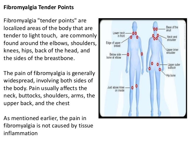 Fibromyalgia quiz