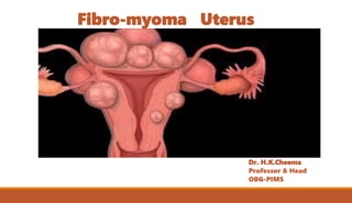 Fibro-myoma Uterus
Dr. H.K.Cheema
Professor & Head
OBG-PIMS
 