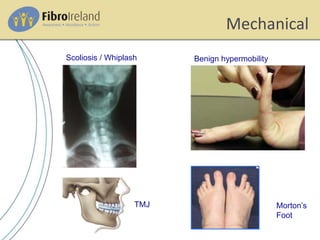 Mechanical
Scoliosis / Whiplash Benign hypermobility
TMJ Morton’s
Foot
 