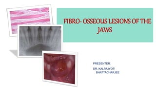 FIBRO- OSSEOUS LESIONS OF THE
JAWS
PRESENTER:
DR. KALPAJYOTI
BHATTACHARJEE
 