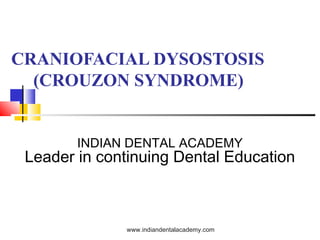 CRANIOFACIAL DYSOSTOSIS
(CROUZON SYNDROME)
INDIAN DENTAL ACADEMY
Leader in continuing Dental Education
www.indiandentalacademy.com
 