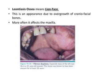 Fibro Osseous Lesions Of Head Neck PPTX