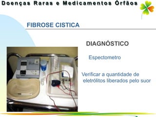 FIBROSE CISTICA


                   DIAGNÓSTICO

                     Espectometro


                  Verificar a quantidade de
                  eletrólitos liberados pelo suor




                                  Ir p/ primeira página
 