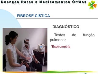 FIBROSE CISTICA

                   DIAGNÓSTICO

                    Testes        de           função
                  pulmonar
                  *Espirometria




                                   Ir p/ primeira página
 
