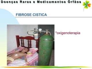 FIBROSE CISTICA




                  *oxigenoterapia




                          Ir p/ primeira página
 