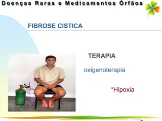 FIBROSE CISTICA



                   TERAPIA

                  oxigenoterapia


                           *Hipoxia



                               Ir p/ primeira página
 