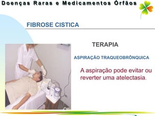 FIBROSE CISTICA


                      TERAPIA

             ASPIRAÇÃO TRAQUEOBRÔNQUICA


                  A aspiração pode evitar ou
                  reverter uma atelectasia.




                               Ir p/ primeira página
 