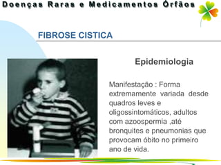 FIBROSE CISTICA


                     Epidemiologia

              Manifestação : Forma
              extremamente variada desde
              quadros leves e
              oligossintomáticos, adultos
              com azoospermia ,até
              bronquites e pneumonias que
              provocam óbito no primeiro
              ano de vida.
                              Ir p/ primeira página
 