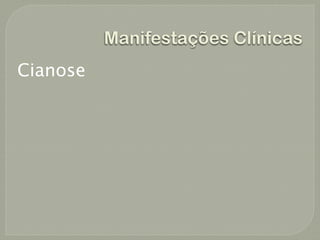 Manifestações Clínicas
Cianose
 