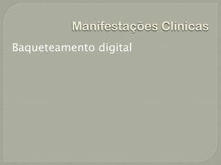 Manifestações Clínicas
Baqueteamento digital
 