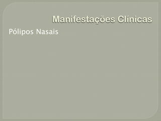 Manifestações Clínicas
Pólipos Nasais
 
