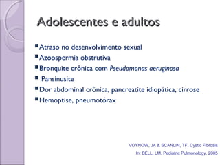 VOYNOW, JA & SCANLIN, TF. Cystic Fibrosis
In: BELL, LM. Pediatric Pulmonology, 2005
Adolescentes e adultosAdolescentes e adultos
Atraso no desenvolvimento sexual
Azoospermia obstrutiva
Bronquite crônica com Pseudomonas aeruginosa
 Pansinusite
Dor abdominal crônica, pancreatite idiopática, cirrose
Hemoptise, pneumotórax
 