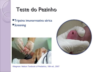Teste do PezinhoTeste do Pezinho
Tripsina imunorreativa sérica
Screening
Kliegman: Nelson Textbook of Pediatrics, 18th ed., 2007
 