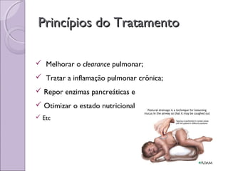  Melhorar o clearance pulmonar;
 Tratar a inflamação pulmonar crônica;
 Repor enzimas pancreáticas e
 Otimizar o estado nutricional
 Etc
Princípios do TratamentoPrincípios do Tratamento
 