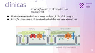 22
associação com as alterações nos
canais CFTR
● Limitada secreção de cloro e maior reabsorção de sódio e água
● Secreções espessas -> obstrução de glândulas, ductos e vias aéreas
Manifestações
clínicas
Adaptado de Mishra, Greaves et al., 2005
 