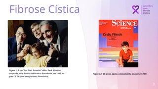 Figura 1: Lap-Chee Tsui, Francis Collis e Jack Riordan
(esquerda para direita) celebram a descoberta, em 1989, do
gene CFTR com uma paciente fibrocística.
3
Figura 2: 30 anos após a descoberta do gene CFTR
Fibrose Cística
 