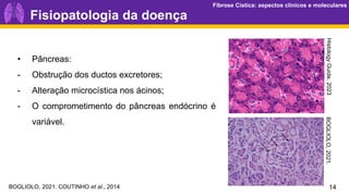 Fibrose Cística: aspectos clínicos e moleculares
Fibrose Cística: aspectos clínicos e moleculares
14
Fisiopatologia da doença
Histology
Guide,
2023
• Pâncreas:
- Obstrução dos ductos excretores;
- Alteração microcística nos ácinos;
- O comprometimento do pâncreas endócrino é
variável.
BOGLIOLO,
2021.
BOGLIOLO, 2021. COUTINHO et al., 2014
 