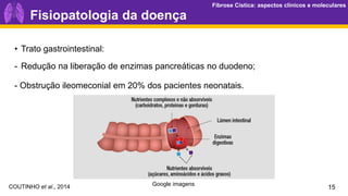 Fibrose Cística: aspectos clínicos e moleculares
Fibrose Cística: aspectos clínicos e moleculares
15
Fisiopatologia da doença
• Trato gastrointestinal:
- Redução na liberação de enzimas pancreáticas no duodeno;
- Obstrução ileomeconial em 20% dos pacientes neonatais.
Google imagens
COUTINHO et al., 2014
 