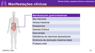 Fibrose Cística: aspectos clínicos e moleculares
Fibrose Cística: aspectos clínicos e moleculares
Manifestações gastrointestinais
Íleo meconial
Atresia Intestinal
Esteatorreia
Diarreia Crônica
Desnutrição
Deficiência de vitaminas lipossolúveis
Síndrome da obstrução intestinal distal
Prolapso retal
Manifestações clínicas
17
CONITEC, 2022
 