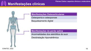 Fibrose Cística: aspectos clínicos e moleculares
Fibrose Cística: aspectos clínicos e moleculares
Manifestações clínicas
Manifestações Osteoarticulares
Osteopenia e osteoporose
Baqueteamento digital
Manifestações da perda salina
Anormalidades dos eletrólitos do suor
Desidratação hiponatrêmica
19
CONITEC, 2022
 