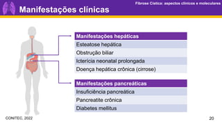 Fibrose Cística: aspectos clínicos e moleculares
Fibrose Cística: aspectos clínicos e moleculares
Manifestações clínicas
Manifestações hepáticas
Esteatose hepática
Obstrução biliar
Icterícia neonatal prolongada
Doença hepática crônica (cirrose)
Manifestações pancreáticas
Insuficiência pancreática
Pancreatite crônica
Diabetes mellitus
20
CONITEC, 2022
 