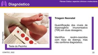 Fibrose Cística: aspectos clínicos e moleculares
Fibrose Cística: aspectos clínicos e moleculares
Diagnóstico
Teste do Pezinho
Triagem Neonatal
Quantificação dos níveis de
tripsinogênio imunorreativo
(TIR) em duas dosagens;
Identifica recém-nascidos
com risco da doença, mas
não confirma diagnóstico.
Google
imagens
22
CONITEC, 2022
 