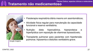 Fibrose Cística: aspectos clínicos e moleculares
Fibrose Cística: aspectos clínicos e moleculares
27
• Fisioterapia respiratória diária mesmo em assintomáticos;
• Nutrição: dieta hipercalórica, hiperproteica e
hiperlipídica com reposição de vitaminas lipossolúveis;
• Transplante pulmonar para pacientes com hipertensão
pulmonar, hipoxemia e distúrbio ventilatório grave.
• Atividade física regular para manutenção da capacidade
funcional e reserva ventilatória;
Tratamento não medicamentoso
Google imagens
CONITEC, 2022
 