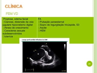 21
Proptose, edema facial
Cianose, distensão da veia
jugulare hipocratismo digital
Atraso de crescimento
Caracteres sexuais
subdesenvolvidos
Icterícia
FA
Pulsação paraesternal
Sopro de regurgitação tricúspide, S3
Ascite
HEM
 