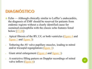  Echo — Although clinically similar to Loffler’s endocarditis,
the diagnosis of EMF should be reserved for patients from
endemic regions without a clearly identified cause for
sustained eosinophilia with the classic echo features listed
below [37,38]:
 Apical fibrosis of the RV, LV, or both ventricles (figure 4 and
figure 1 and figure 5)
 Tethering the AV valve papillary muscles, leading to mitral
and/or tricuspid regurgitation (figure 1)
 Giant atrial enlargement (figure 4 and figure 1)
 A restrictive filling pattern on Doppler recordings of mitral
valve inflow (figure 6)
27
 