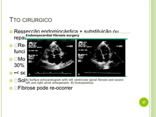 TTO CIRURGICO
 Ressecção endomiocárdica + substituição ou
reparação valvular
 Recomendado a todos pacientes em classe
funcional III-IV (NYHA)
 Mortalidade pós-operatória imediata alta (15 –
30%)
 ▪< se não for necessário substituição valvular
 Sobrevivência a longo termo alta
 Fibrose pode re-ocorrer
37
 