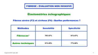 Claude EUGENE Juillet 2020
FIBROSE : ÉVALUATION NON INVASIVE
Élastométries échographiques
Fibrose sévère (F3) et cirrhose (F4) : Quelles performances ?
39
Méthodes Sensibilité Spécificité
Fibroscan* 79%-97% 81%-87%
Autres techniques 81%-95% 77%-96%
 