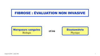 Claude EUGÈNE Juillet 2020
FIBROSE : ÉVALUATION NON INVASIVE
6
Marqueurs sanguins
Biologie
et/ou Élastométrie
Physique
 