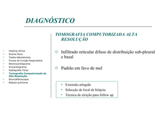 DIAGNÓSTICO TOMOGRAFIA COMPUTORIZADA ALTA RESOLUÇÃO Infiltrado reticular difuso de distribuição sub-pleural e basal Padrão em favo de mel História clínica Exame físico Testes laboratoriais Provas de Função Respiratória Electrocardiograma Ecocardiograma Radiografia Tórax Tomografia Computorizada de Alta Resolução Broncofibroscopia Biópsia pulmonar Extensão atingida Selecção de local de biópsia Técnica de eleição para follow up 