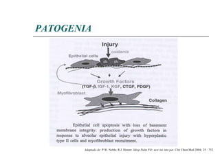 PATOGENIA Adaptado de:  P.W. Noble, R.J. Homer . Idiop Pulm Fib: new ins into pat.  Clin Chest Med 2004 ;  25  :  752 