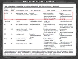 FIBROSE PULMONAR IDIOPÁTICA
 