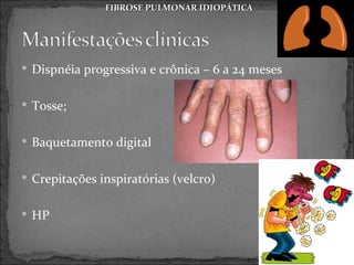 FIBROSE PULMONAR IDIOPÁTICA




 Dispnéia progressiva e crônica – 6 a 24 meses


 Tosse;


 Baquetamento digital


 Crepitações inspiratórias (velcro)


 HP
 