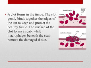 • A clot forms in the tissue. The clot
gently binds together the edges of
the cut to keep and protect the
healthy tissue. The surface of the
clot forms a scab, while
macrophages beneath the scab
remove the damaged tissue.
 