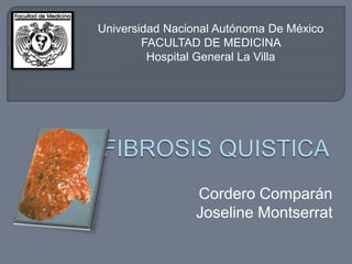 Cordero Comparán
Joseline Montserrat
Universidad Nacional Autónoma De México
FACULTAD DE MEDICINA
Hospital General La Villa
 
