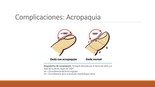 Complicaciones: Acropaquia
 